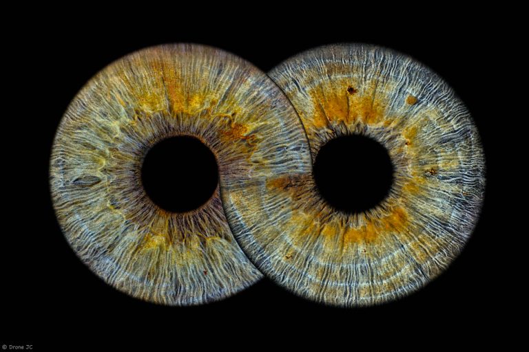 iris-humain-06